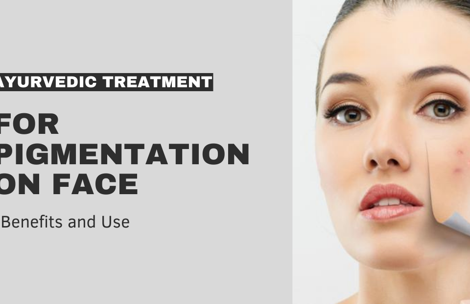 ayurvedic treatment for pigmentation on face